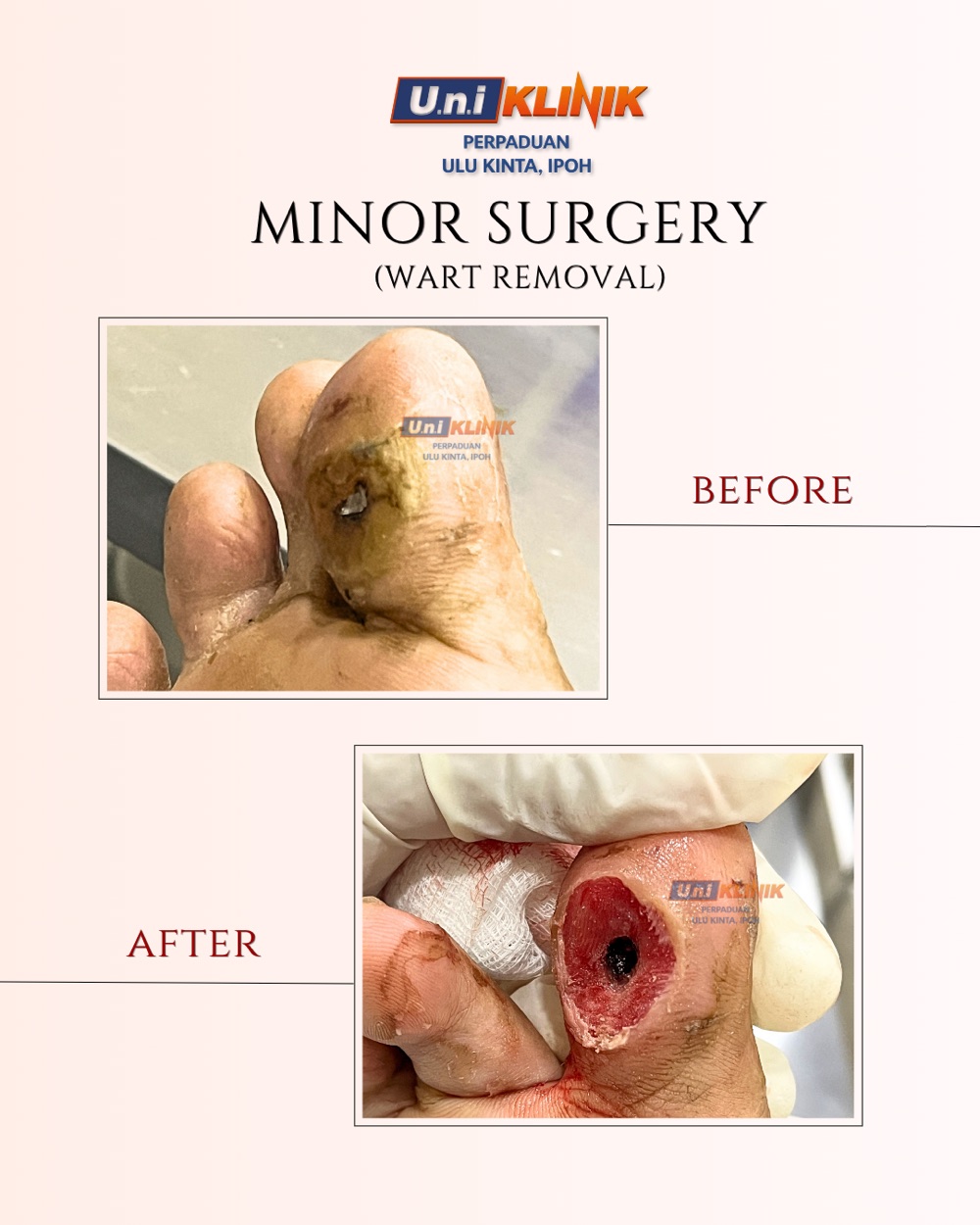 Hasil rawatan Uniklinik Perpaduan