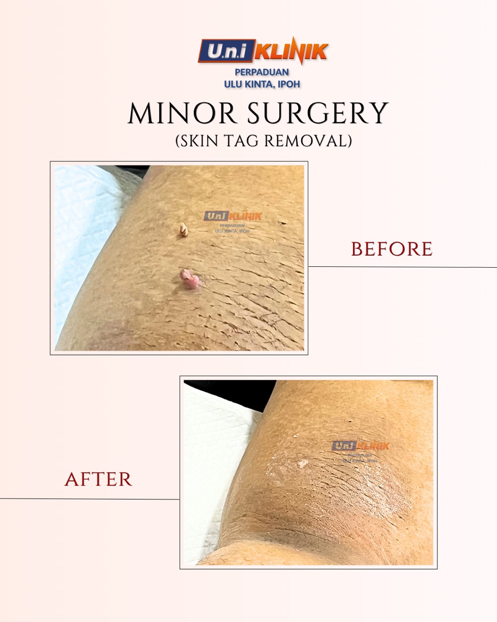 Hasil rawatan Uniklinik Perpaduan