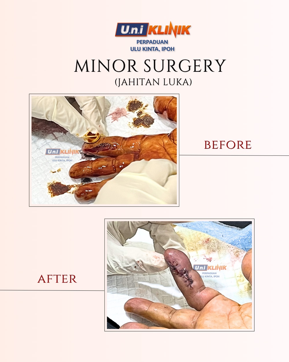 Hasil rawatan Uniklinik Perpaduan