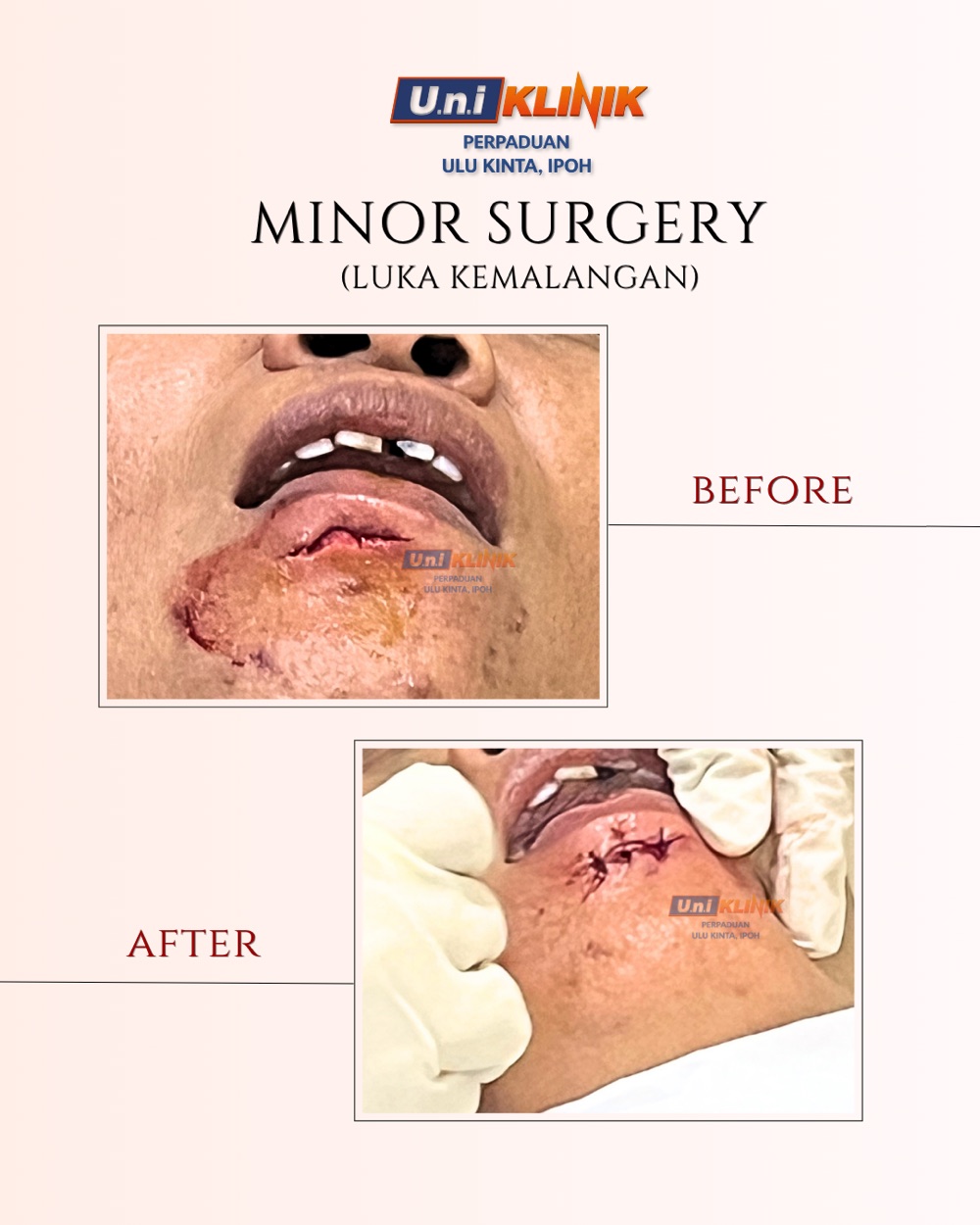 Hasil rawatan Uniklinik Perpaduan