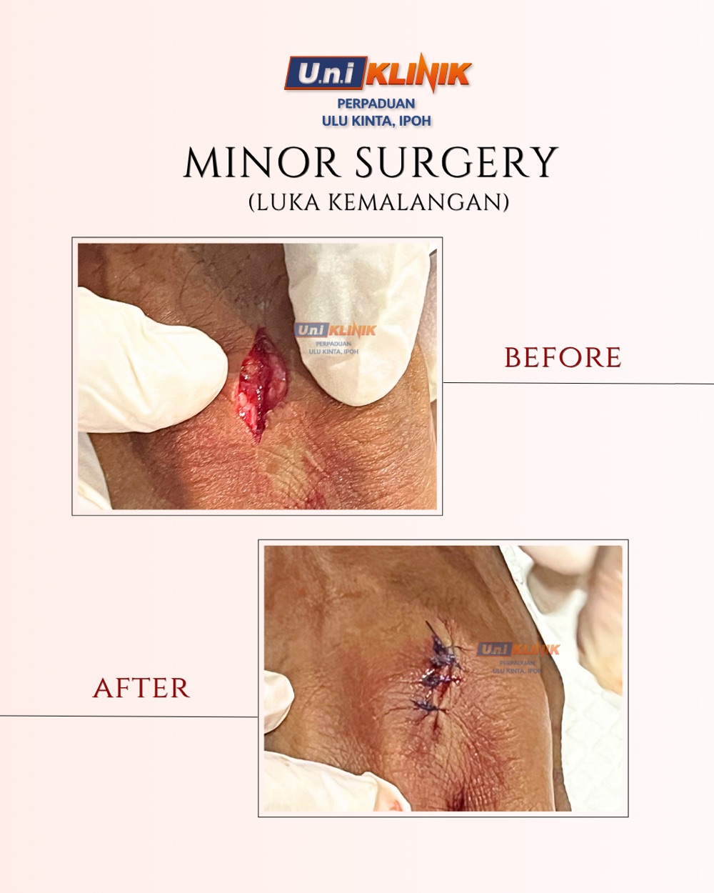 Hasil rawatan Uniklinik Perpaduan