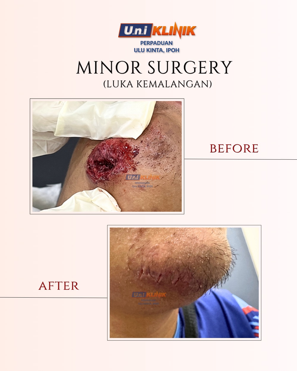 Hasil rawatan Uniklinik Perpaduan
