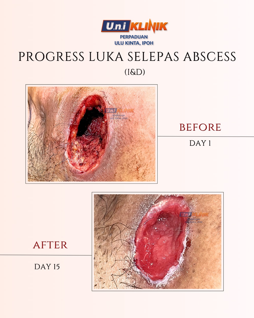 Hasil rawatan Uniklinik Perpaduan