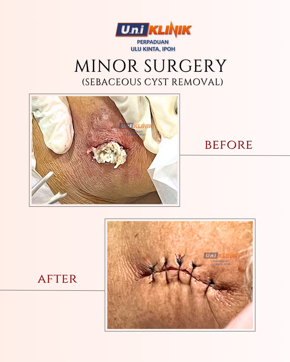 Hasil rawatan Uniklinik Perpaduan