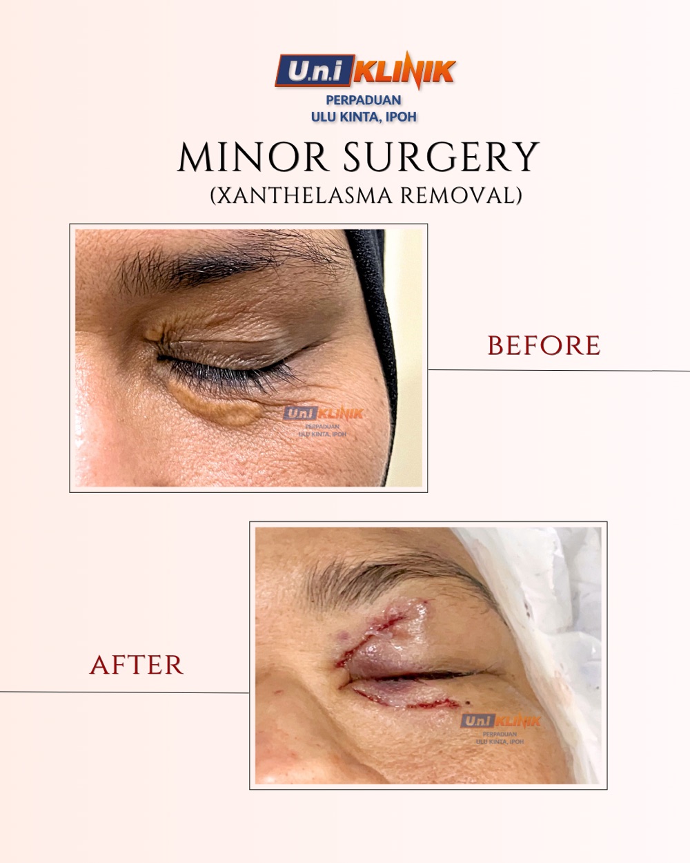 Hasil rawatan Uniklinik Perpaduan