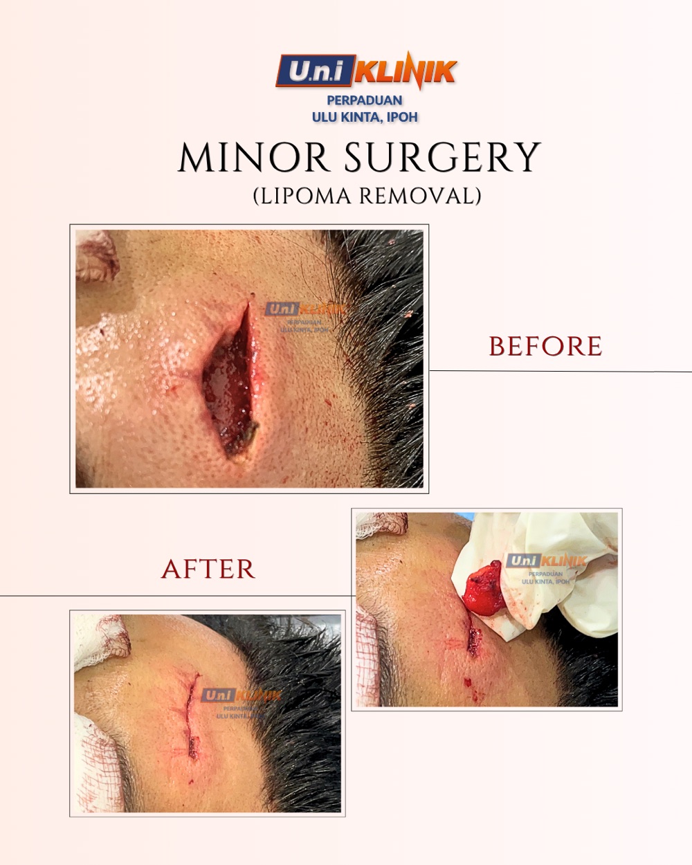 Hasil rawatan Uniklinik Perpaduan